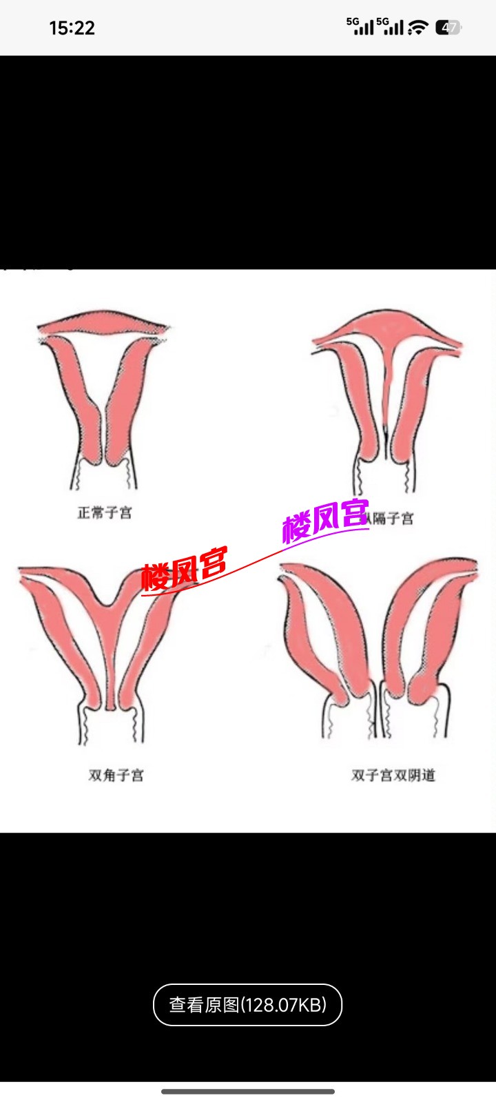 Screenshot_2026-05-17-15-22-31-940_com.uneed.yuni.jpg